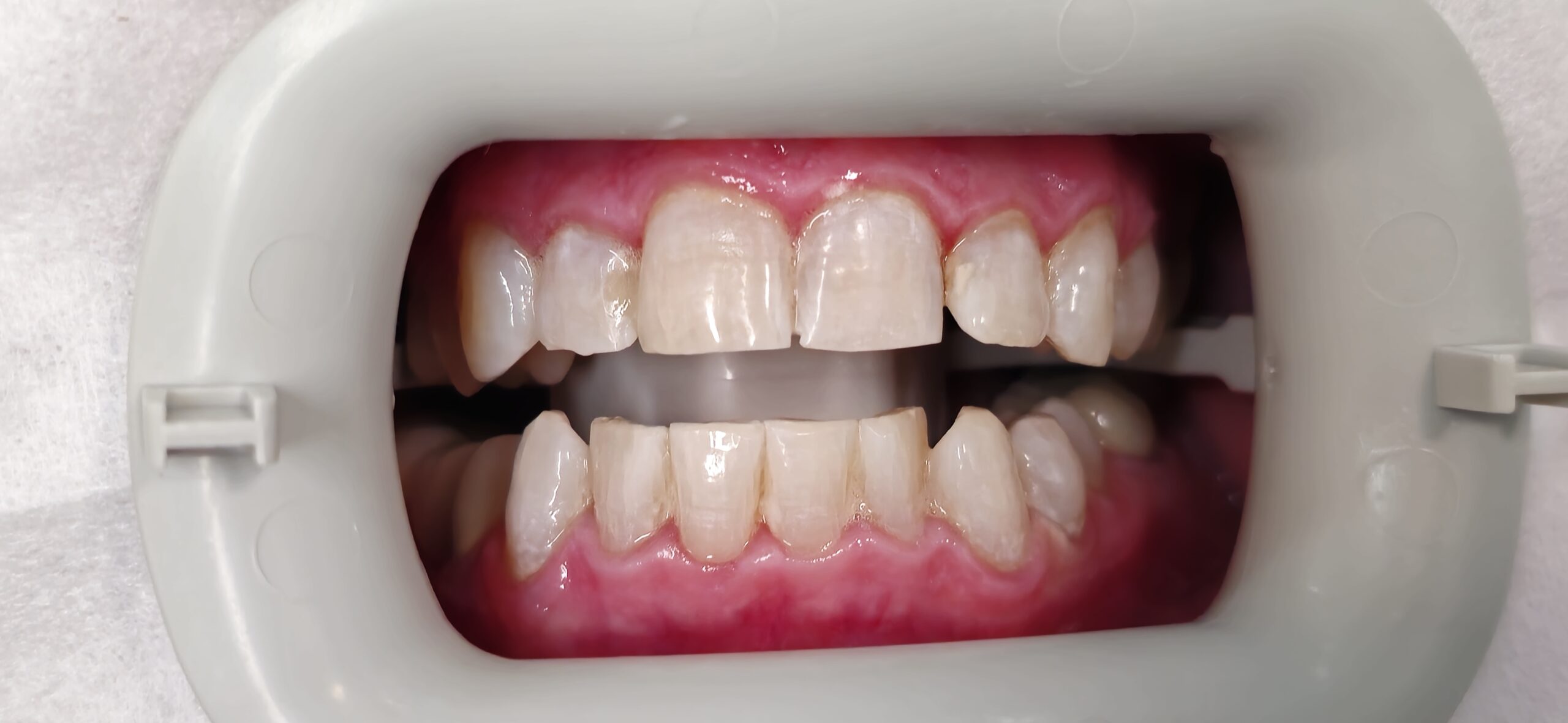 After Image