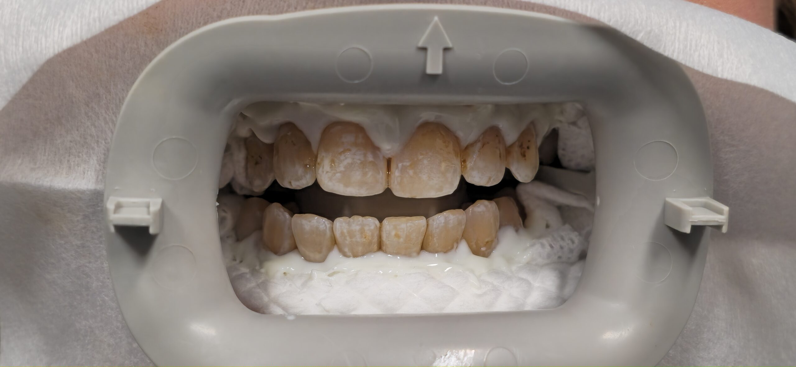 Before Image