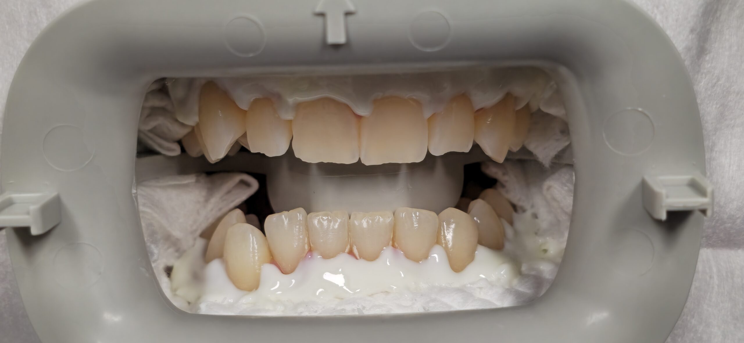 Before Image