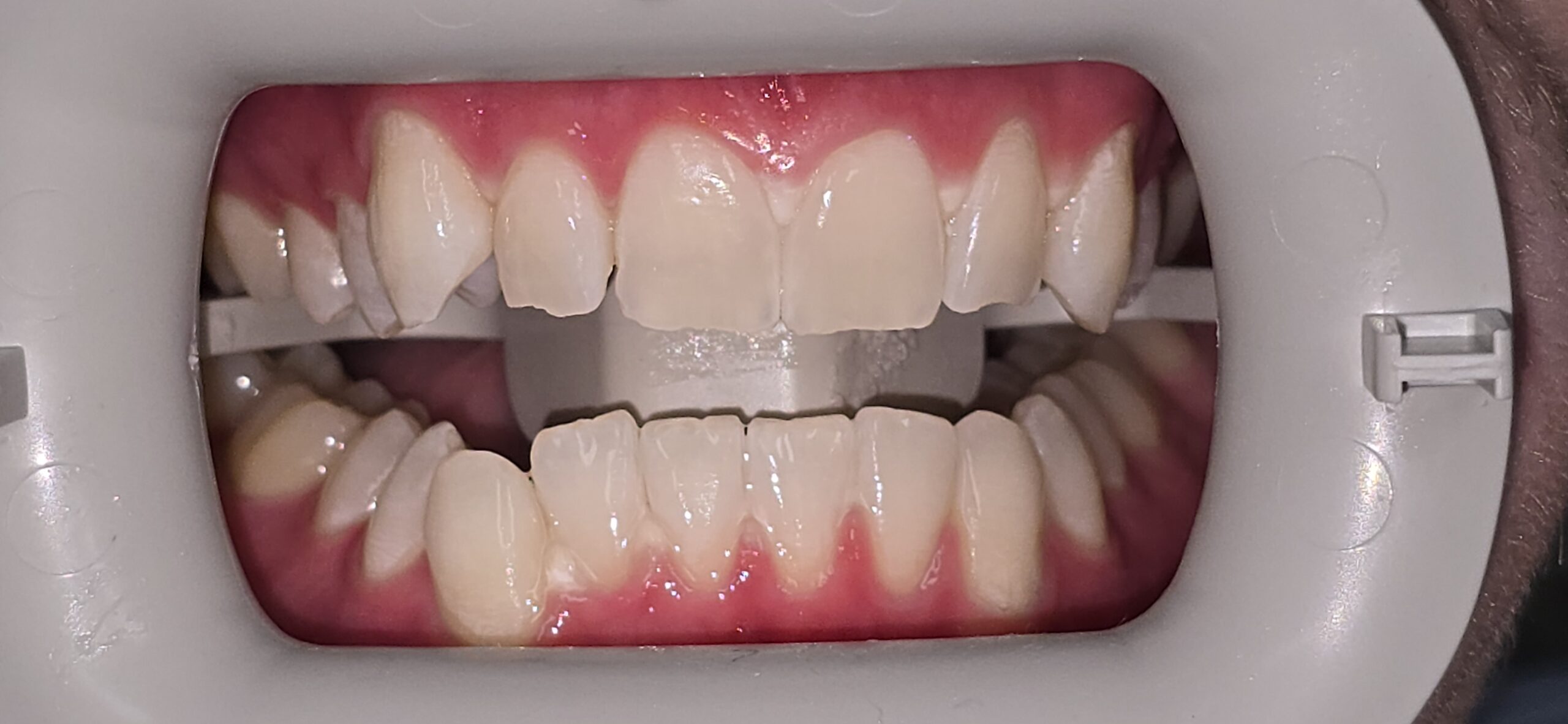 After Image